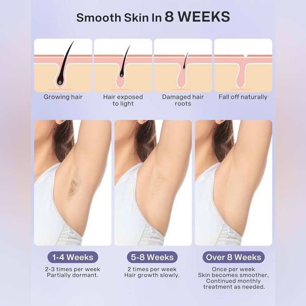 New Permanent Laser Hair Removal Device - Picture 3 of 6